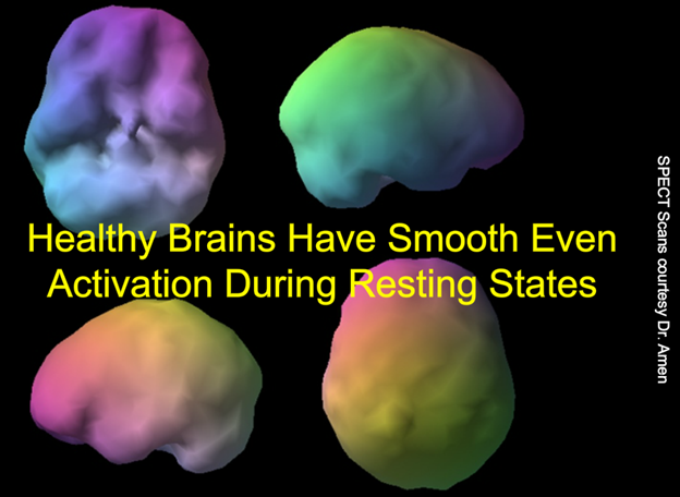 healthy brain scan